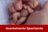 Avortements spontanés à répétition (ASR)